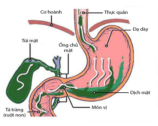 khong-chu-quan-voi-benh-trao-nguoc-dich-mat-3