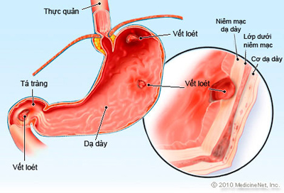 benh-viem-niem-mac-da-day-co-nguy-hiem-khong-2