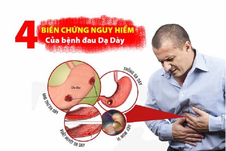 Đau bao tử gây ra nhiều vấn đề nghiêm trọng với sức khỏe