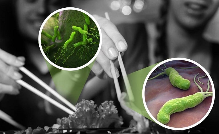 Bệnh viêm loét HP dạ dày là do một loại vi khuẩn đường ruột Helicobacter pylori gọi tắt là HP gây ra