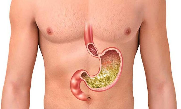 Dạ dày nằm ở đâu là mối quan tâm của rất nhiều người